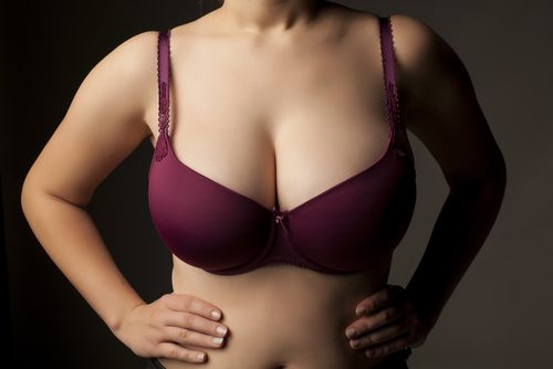 Breast lift patient 01
